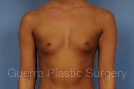 Case #1001182 Before