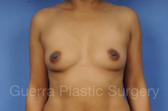 Case #1002003 Before