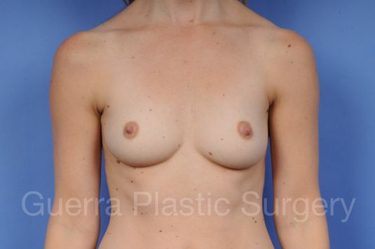 Case #1002018 Before