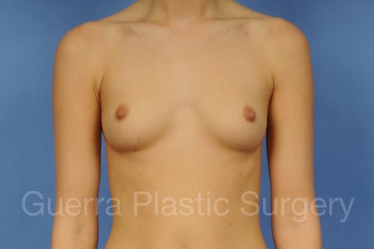 Case #1002020 Before