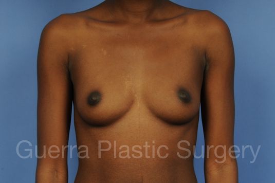 Case #1002021 Before