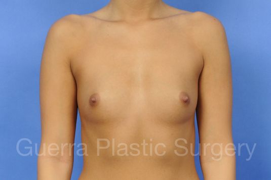 Case #1002023 Before