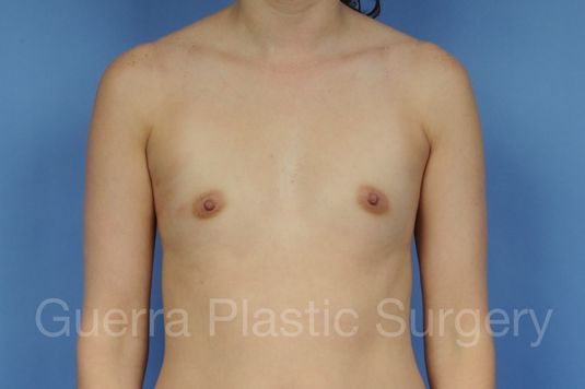 Case #1002030 Before