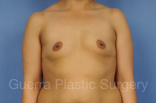 Case #1002031 Before