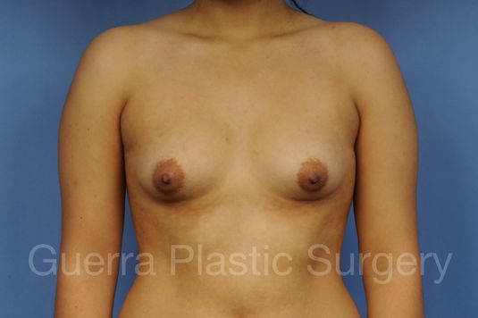 Case #1002025 Before