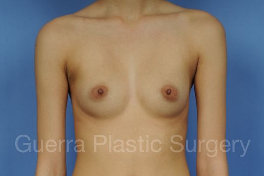 Case #1002024 Before