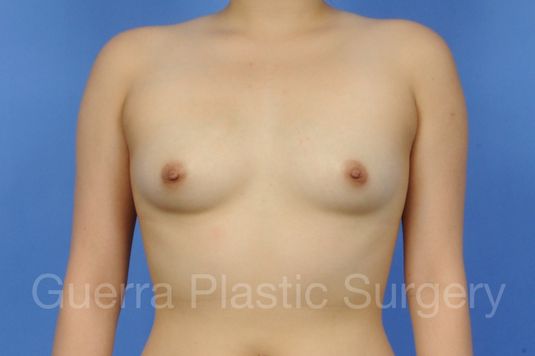 Case #1001118 Before