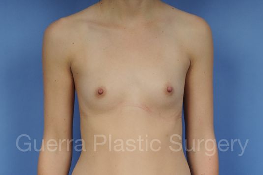 Case #1001123 Before