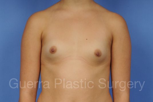 Case #1001136 Before