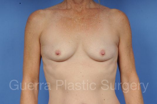 Case #1002048 Before