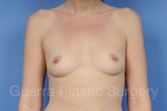 Case #1002049 Before