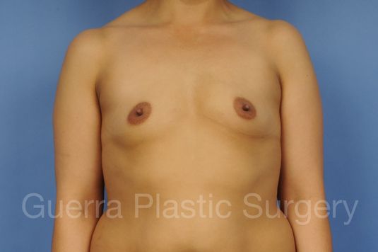 Case #1002050 Before